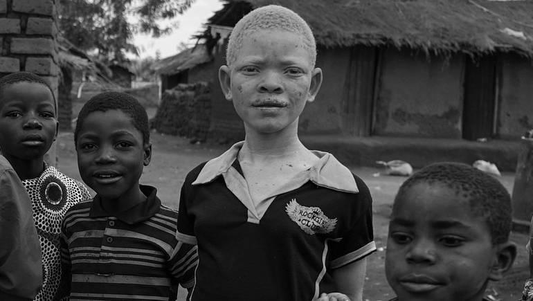 Poverty in Africa